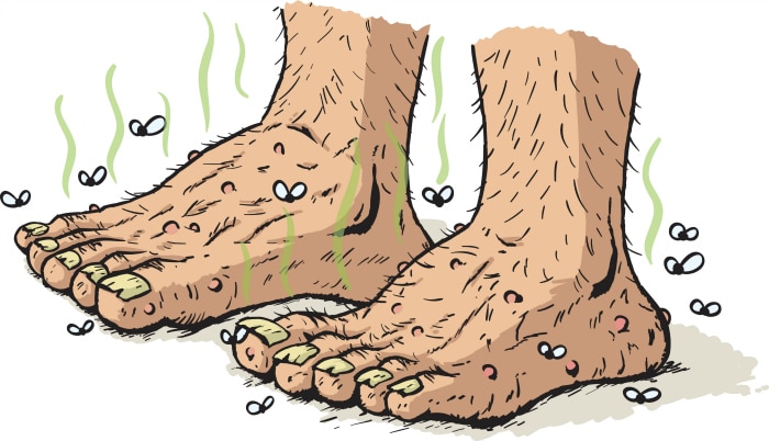 solucionar problemas de sudor: Olor pies