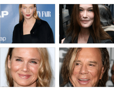 ¿Qué te has hecho en la cara? Uma Thurman y otros famosos irreconocibles