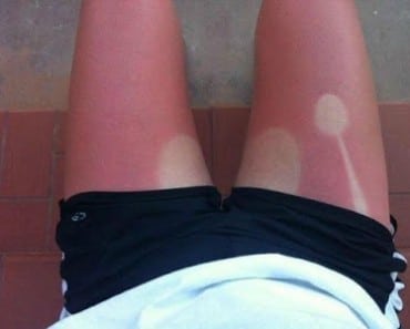 Tatuajes con quemaduras de sol: 17 fotos que demuestran que la gente está loca