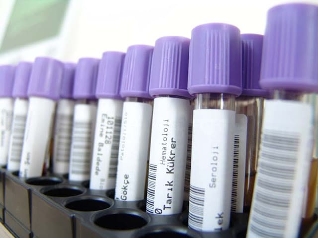 Test no invasivo para la detección del cáncer de colon