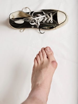 zapatillas juanetes