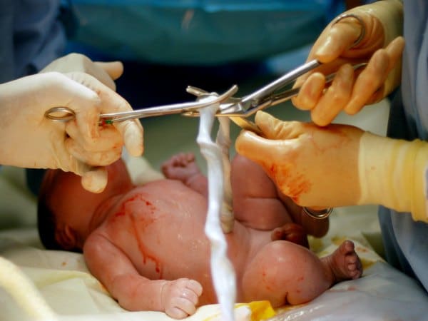 ¿Cuándo se debe cortar el cordón umbilical al nacer?