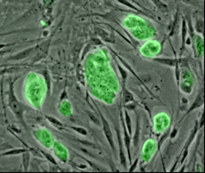 Células madre y distrofia muscular