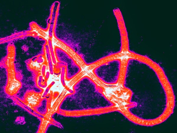 ¿Por qué es tan letal el virus del Ébola?