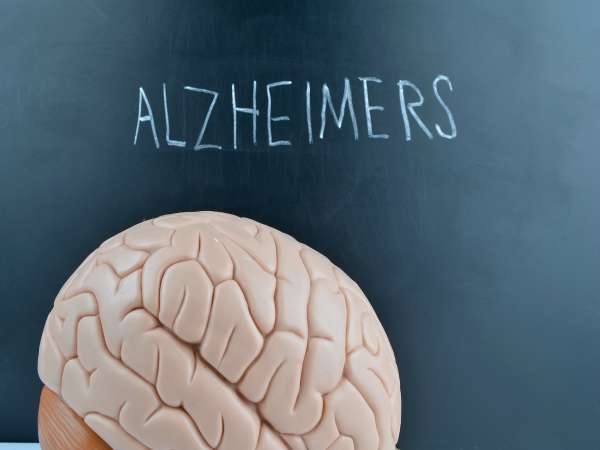 Nueva esperanza para los enfermos de Alzheimer