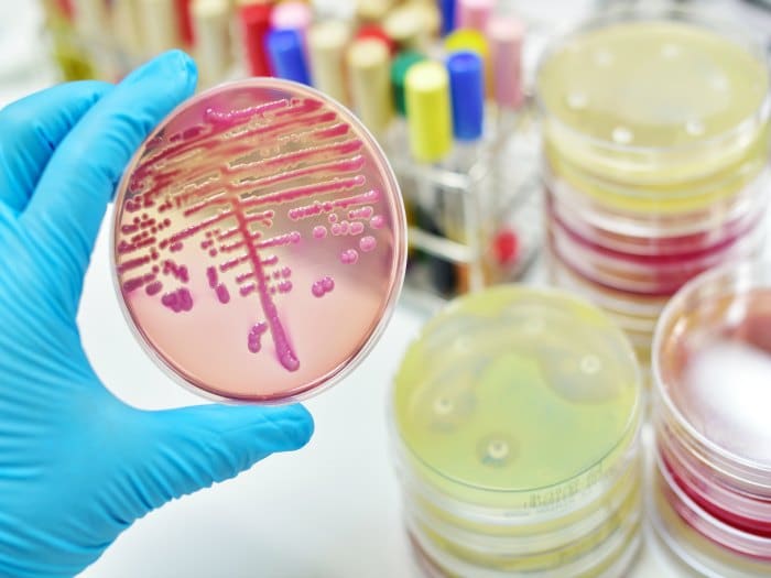 Bacterias resistentes son una amenaza para la salud