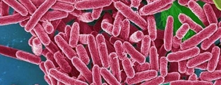 Pseudomonas aeruginosa