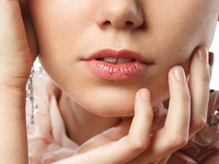Cómo curar los labios agrietados