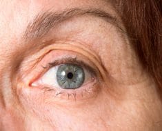 Ojo seco durante la menopausia