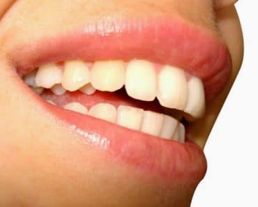 ¿Cómo afecta la menopausia a los dientes y a las encías?