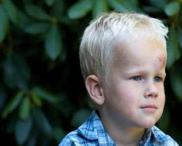 ¿Qué hacer cuando un niño se golpea la cabeza?