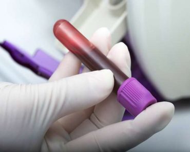 ¿Hay algún test de sangre para detectar el cáncer de colon?