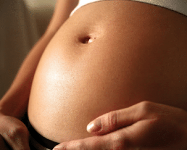 ¿Cómo prevenir las estrías en el embarazo?