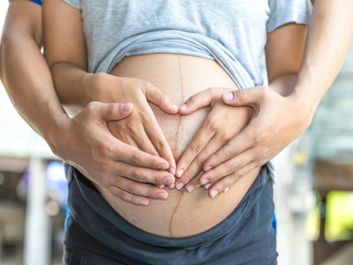 ¿Por qué aparece una linea negra en el abdomen en el embarazo?