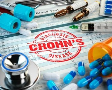¿Cómo saber si tengo la enfermedad de Crohn?