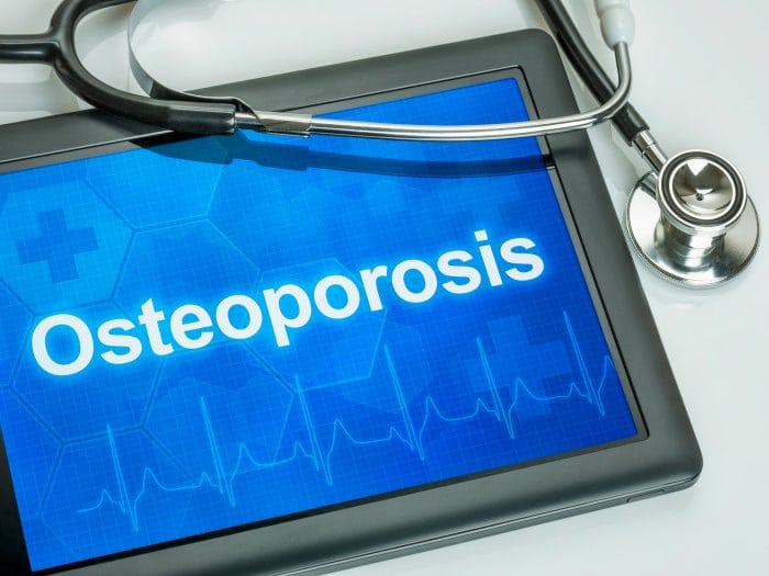 Qué es la osteoporosis