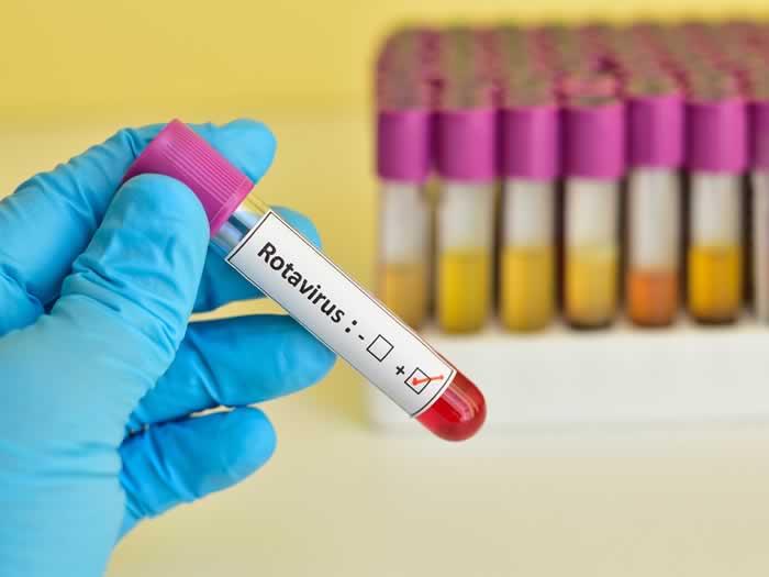 Infección rotavirus Salud