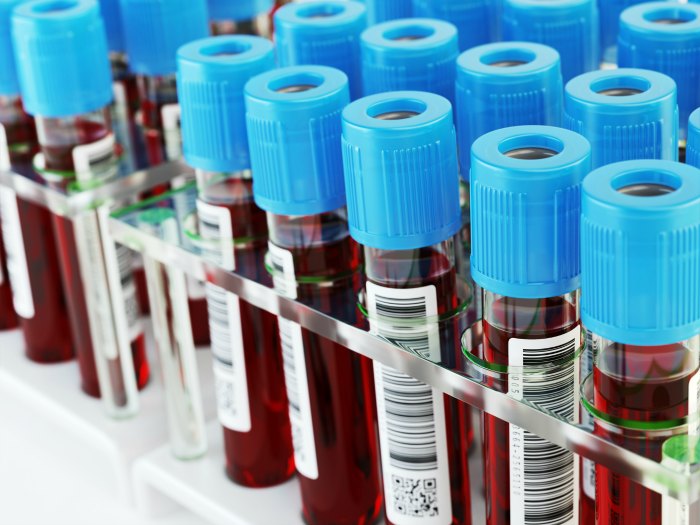 Método no invasivo de detección de cáncer de colon