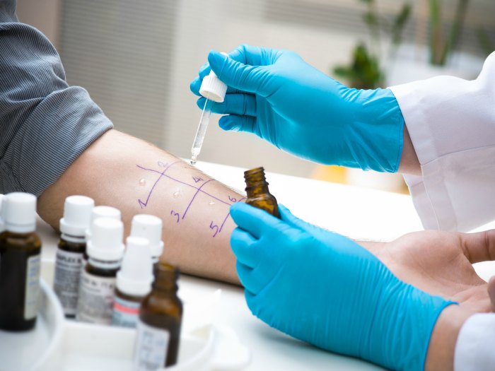 Pruebas para detectar una alergia