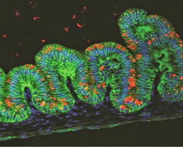 Crean estómagos de laboratorio a partir de células madre