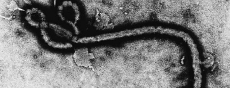 ¿Cómo se contagia el ébola?