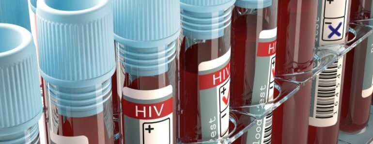 VIH y sida: ¿Es lo mismo?