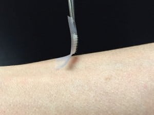 Inventan un parche para controlar la diabetes sin tener que pincharse