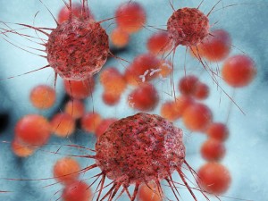 Nanotecnología y cáncer de mama