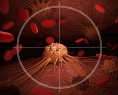 Nuevo tratamiento para el cáncer metastásico con resultados asombrosos