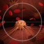 Nuevo tratamiento para el cáncer metastásico con resultados asombrosos
