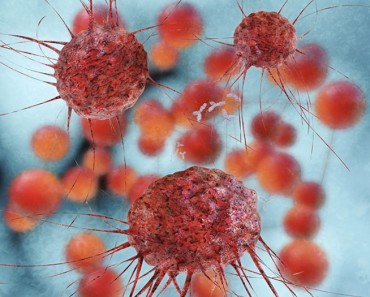 Las nanopartículas cilíndricas son más letales para el cáncer de mama